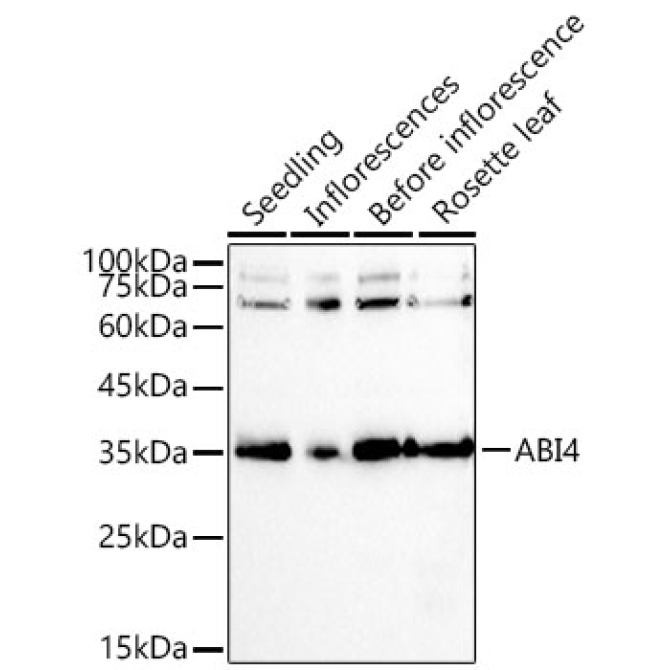 ABI4 Rabbit Polyclonal Antibody