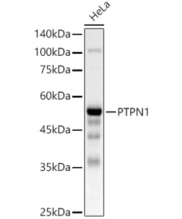 PTPN1 Rabbit Polyclonal Antibody [KO Validated]