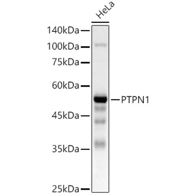 PTPN1 Rabbit Polyclonal Antibody [KO Validated]
