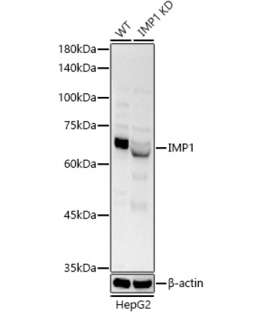 IGF2BP1/IMP1 Rabbit Polyclonal Antibody [KO Validated]