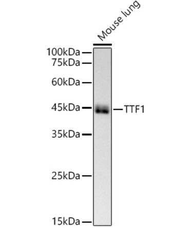 NKX2-1 Rabbit Monoclonal Antibody