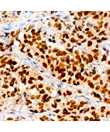 NKX2-1 Rabbit Monoclonal Antibody