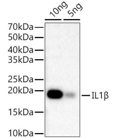 IL1Beta Rabbit Monoclonal Antibody
