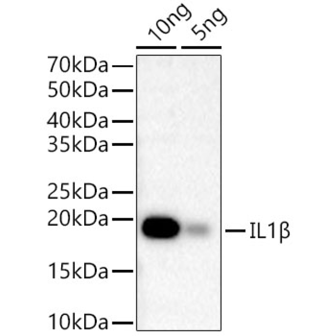 IL1Beta Rabbit Monoclonal Antibody