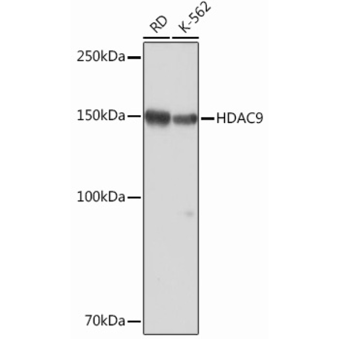 HDAC9 Rabbit Monoclonal Antibody