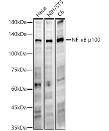 NF-?B2 Rabbit Monoclonal Antibody