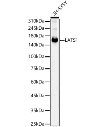 LATS1 Rabbit Monoclonal Antibody