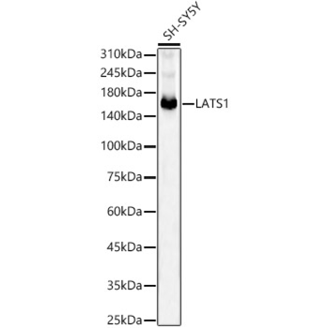 LATS1 Rabbit Monoclonal Antibody