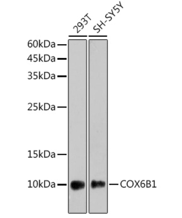 COX6B1 Rabbit Monoclonal Antibody