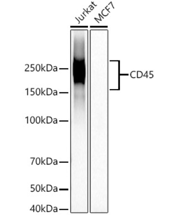 CD45 Rabbit Monoclonal Antibody