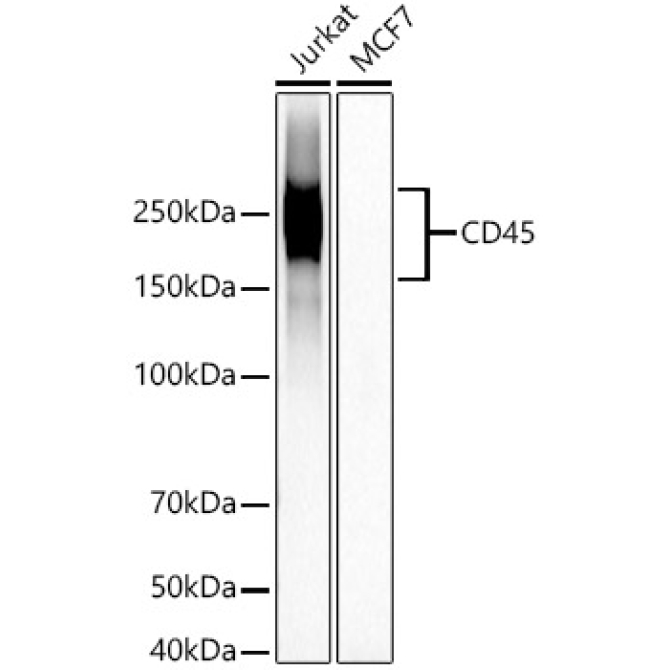 CD45 Rabbit Monoclonal Antibody