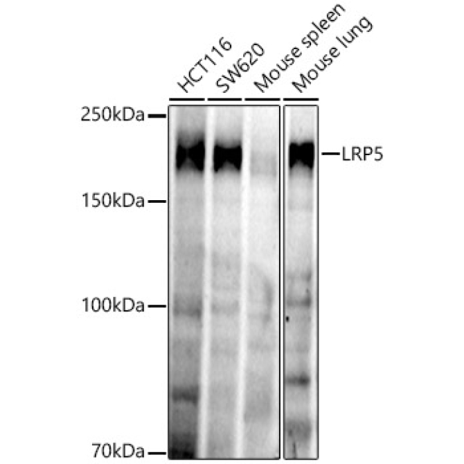 LRP5 Rabbit Monoclonal Antibody