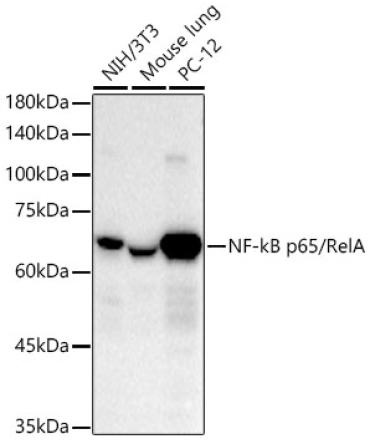 NF-kB p65/RelA Rabbit Monoclonal Antibody [KO Validated]