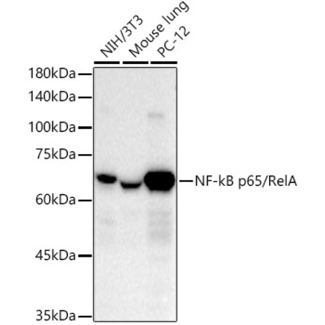 NF-kB p65/RelA Rabbit Monoclonal Antibody [KO Validated]