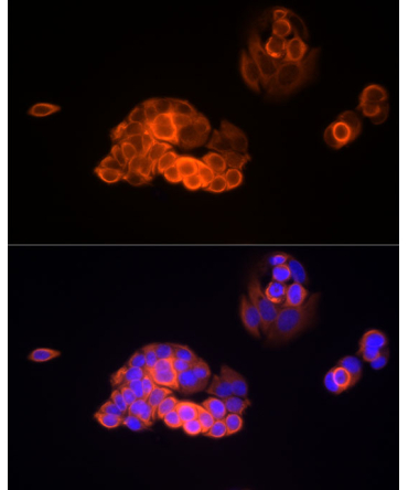 MMP13 Rabbit Monoclonal Antibody