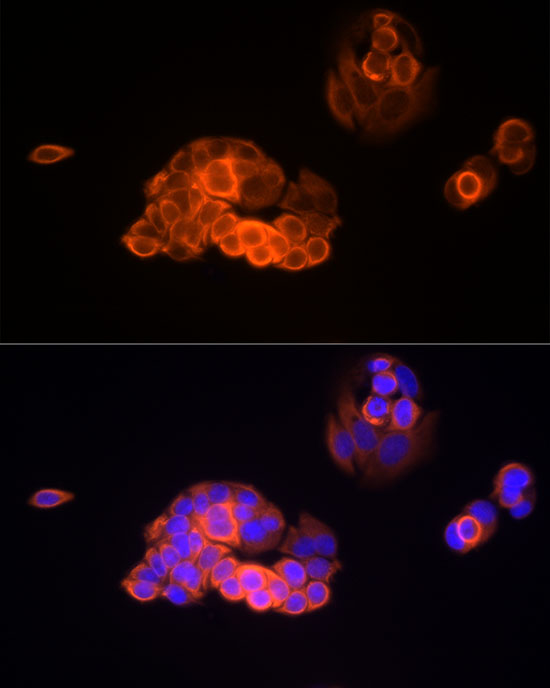 MMP13 Rabbit Monoclonal Antibody