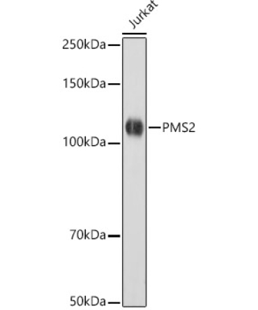 PMS2 Rabbit Monoclonal Antibody [KO Validated]