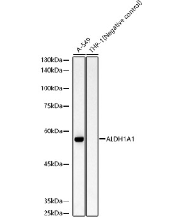 ALDH1A1 Rabbit Monoclonal Antibody