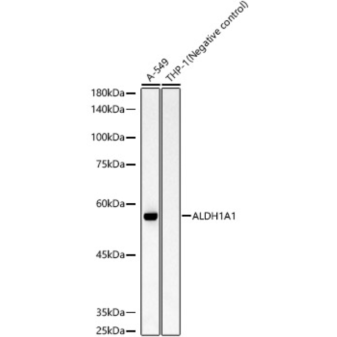 ALDH1A1 Rabbit Monoclonal Antibody