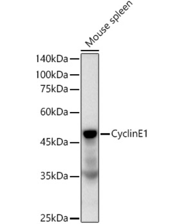 Cyclin E1 Rabbit Monoclonal Antibody
