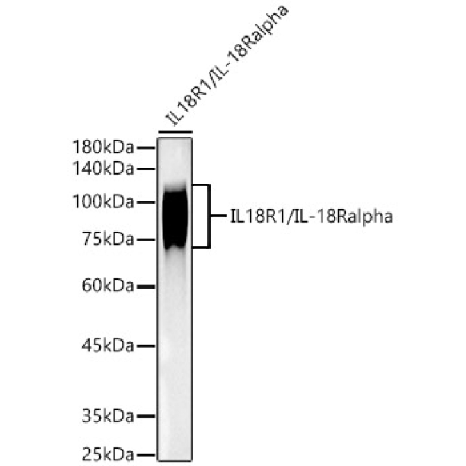 IL18R1/IL-18 R alpha Rabbit Monoclonal Antibody