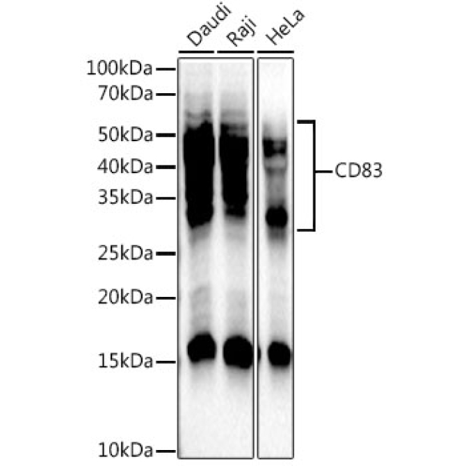 CD83 Rabbit Monoclonal Antibody