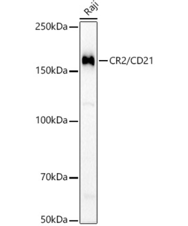 CR2/CD21 Rabbit Monoclonal Antibody