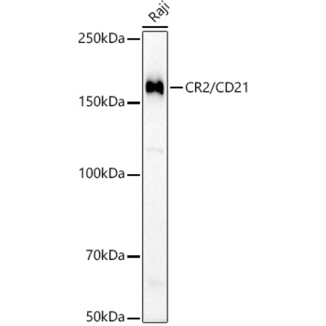 CR2/CD21 Rabbit Monoclonal Antibody