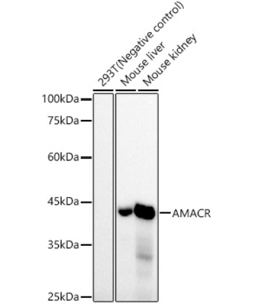 AMACR/p504S Rabbit Monoclonal Antibody