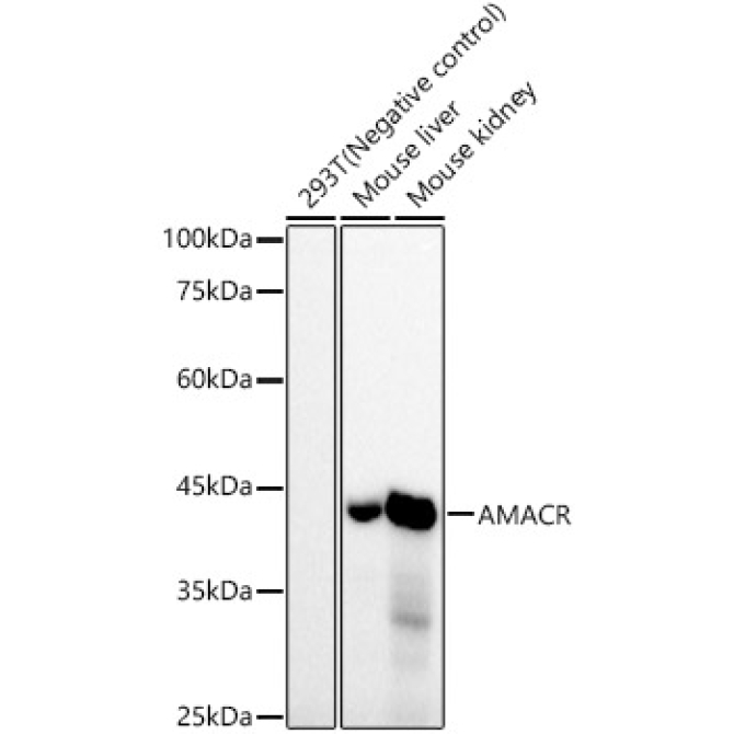 AMACR/p504S Rabbit Monoclonal Antibody
