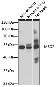MBD2 Rabbit Polyclonal Antibody
