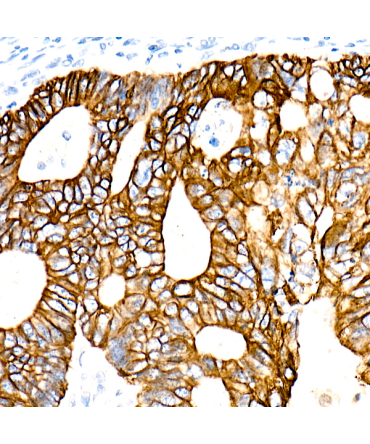 Cytokeratin 19 (KRT19) Rabbit Monoclonal Antibody