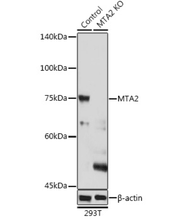 MTA2 Rabbit Polyclonal Antibody [KO Validated]