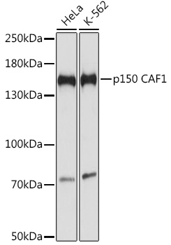 p150 CAF1 Rabbit Polyclonal Antibody