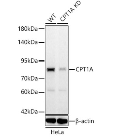CPT1A Rabbit Monoclonal Antibody [KD Validated]