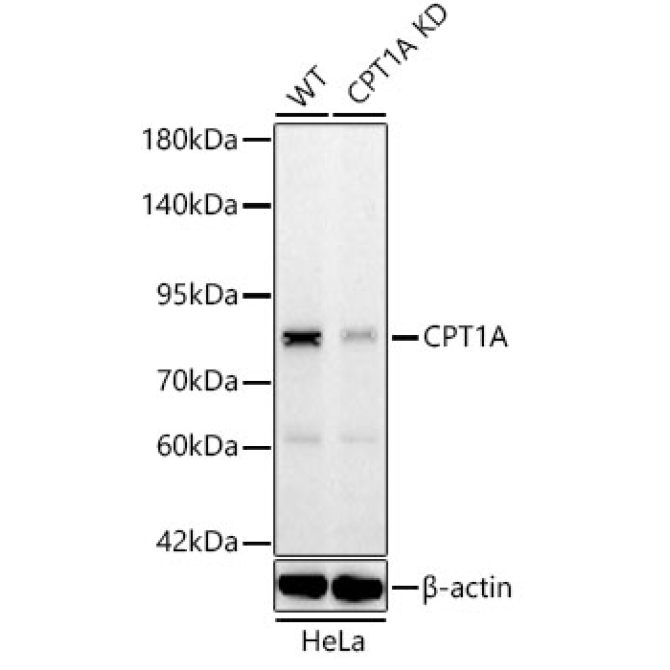 CPT1A Rabbit Monoclonal Antibody [KD Validated]