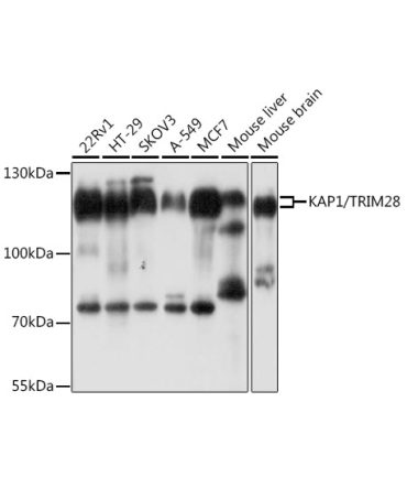 KAP1/TRIM28 Rabbit Polyclonal Antibody