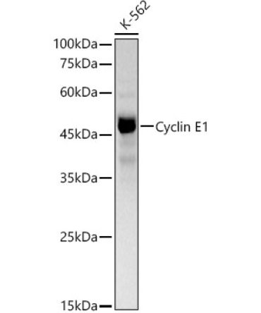 Cyclin E1 Rabbit PolyMonoclonal Antibody?