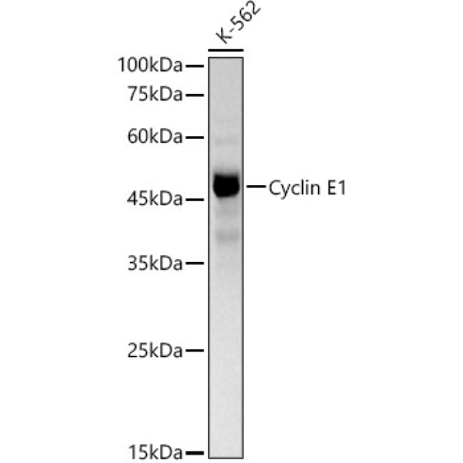 Cyclin E1 Rabbit PolyMonoclonal Antibody?