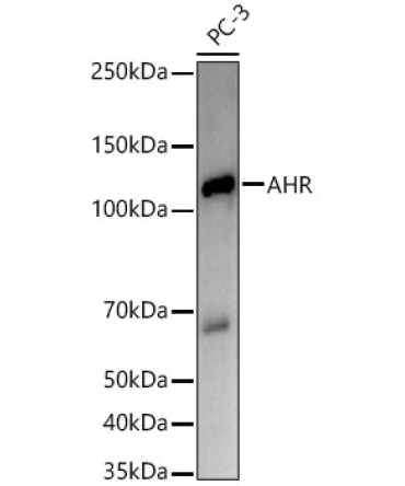 AHR Rabbit PolyMonoclonal Antibody?