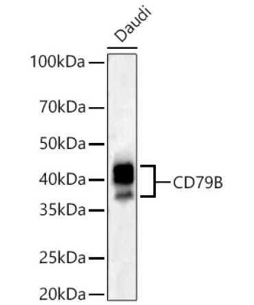 CD79B Rabbit PolyMonoclonal Antibody?
