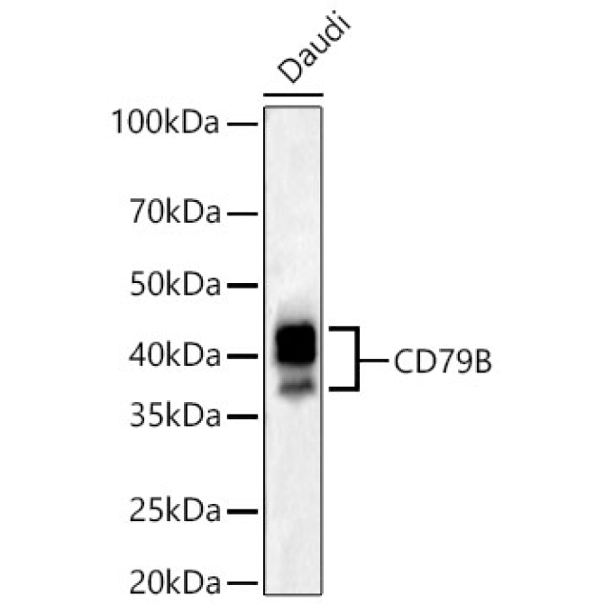 CD79B Rabbit PolyMonoclonal Antibody?