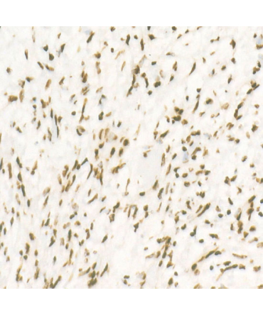 CDK12 Rabbit Monoclonal Antibody