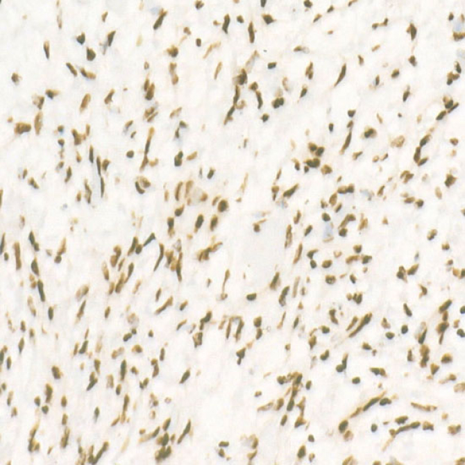 CDK12 Rabbit Monoclonal Antibody