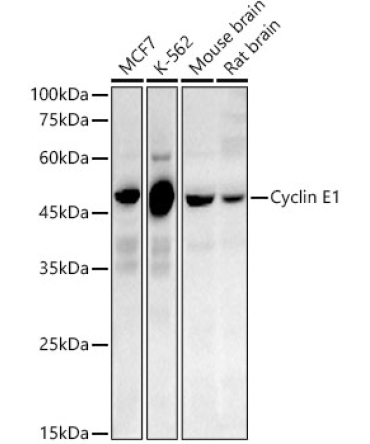 Cyclin E1 Rabbit PolyMonoclonal Antibody?