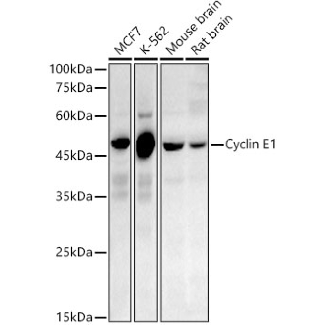 Cyclin E1 Rabbit PolyMonoclonal Antibody?