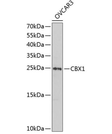 CBX1 Rabbit Polyclonal Antibody