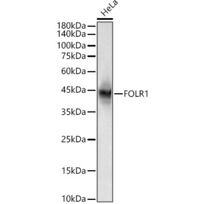 Folate Binding Protein(FBP) / FOLR1 Rabbit PolyMonoclonal Antibody?
