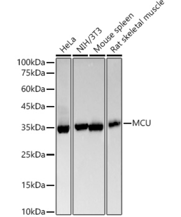 MCU Rabbit Monoclonal Antibody [KO Validated]