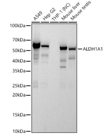ALDH1A1 Rabbit PolyMonoclonal Antibody?